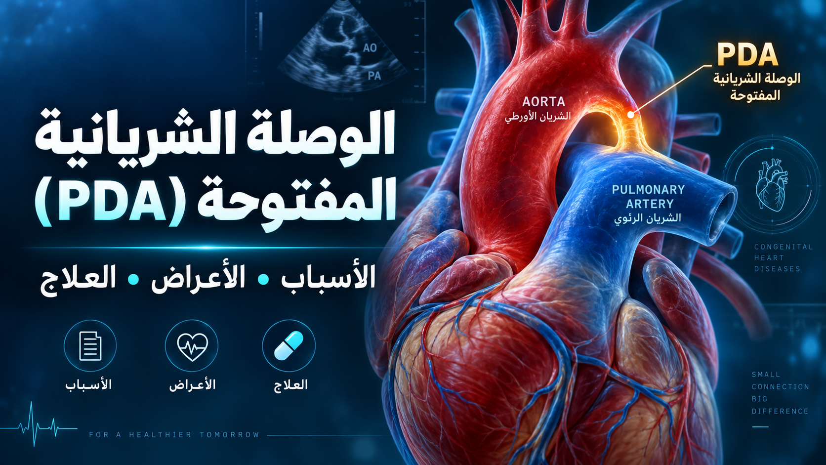 الوصلة الشريانية المفتوحة (PDA) عند الأطفال: الأسباب والأعراض والعلاج