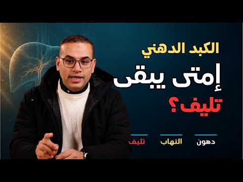 هل الكبد الدهني خطير فعلاً؟ ومتى يتحوّل لتليف